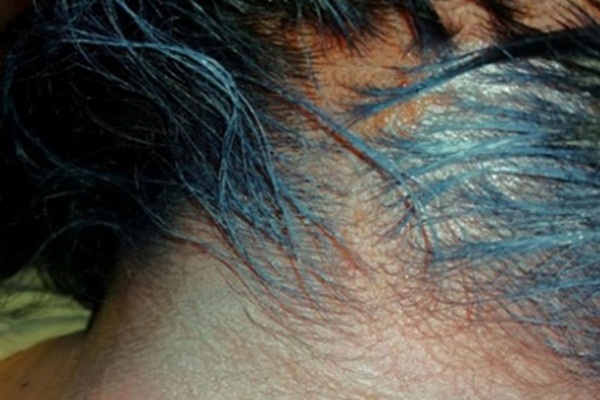 Saç boyası kullananlar dikkat