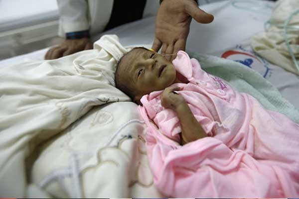 Yemen'de kıtlık alarmı! 'Abluka kalkmazsa dünyanın en büyüğü yaşanacak'