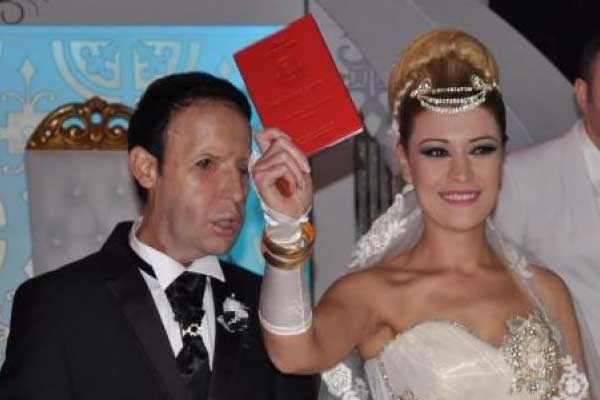 Yüz nakli yapılan Recep Sert tutuklandı