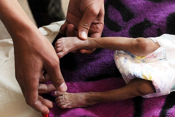 Yemen ablukası üçüncü haftasına girdi