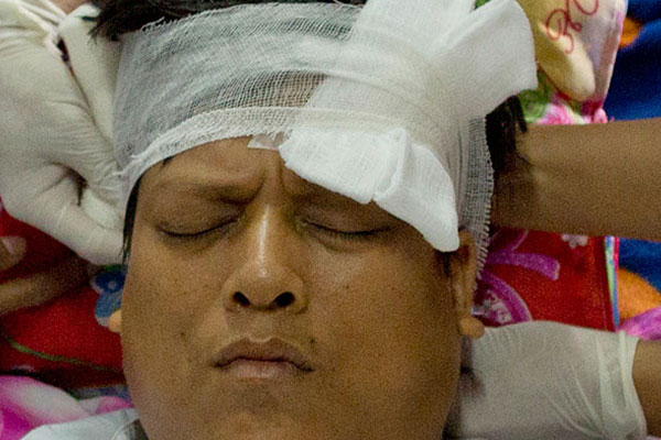 Milletvekili palalı saldırıya uğradı