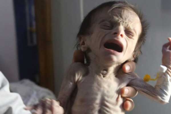 Hastalar Doğu Guta'dan tahliye ediliyor