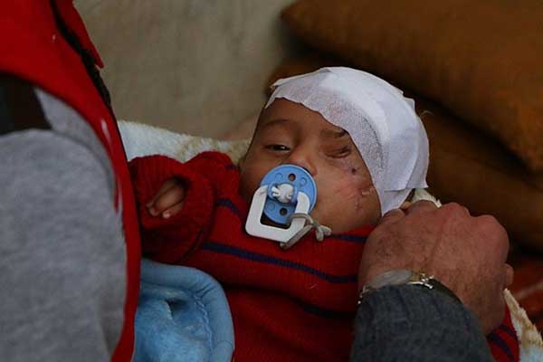 Kerim bebek diğer gözünü de kaybedebilir