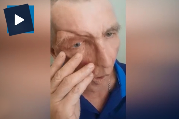 Protez yüzlü adam görenleri hayrete düşürdü!