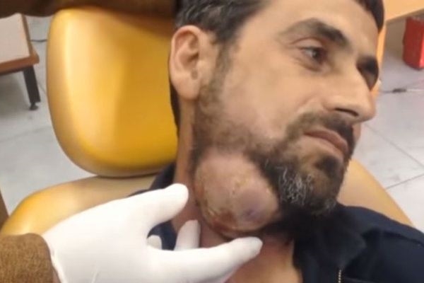 Neşteri vurunca gözlerine inanamadılar