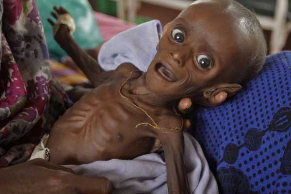 Güney Sudan'da açlık tehdidi