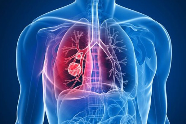 Belçika'da kanseri 15 dakikada teşhis edebilen çip geliştirildi