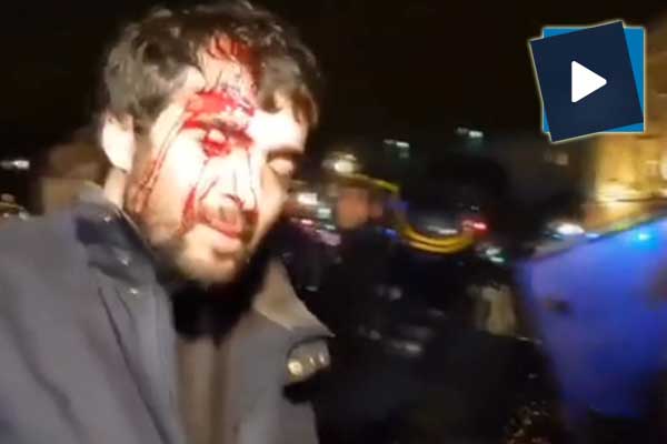 Fransız polisinden PKK destekçilerine müdahale