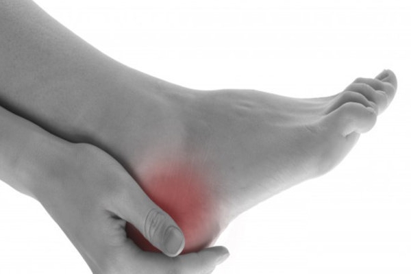 Ayakkabı vurmasına ne iyi gelir?