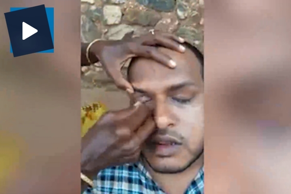 Hindistan sokaklarında mide bulandıran göz muayenesi