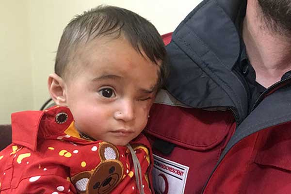 Doğu Guta'daki ablukanın simgesi Kerim Bebek Türkiye'de