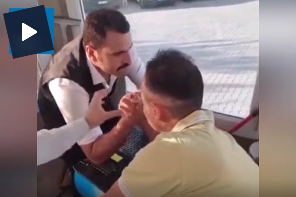 Bilek güreşi yaparken kolu böyle kırıldı