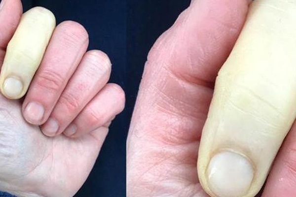 Ünlü sunucu, hastalığını paylaştı