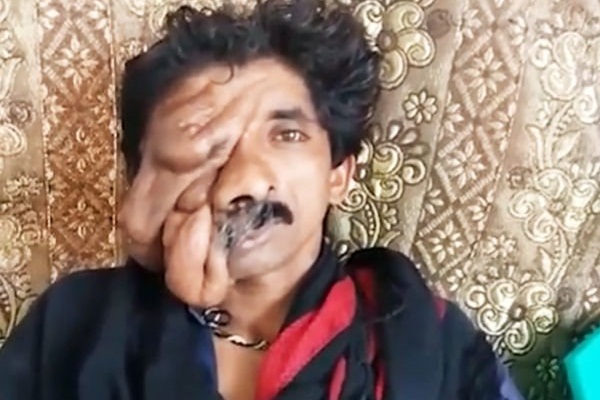 Yüzü tamamen kapanmak üzere