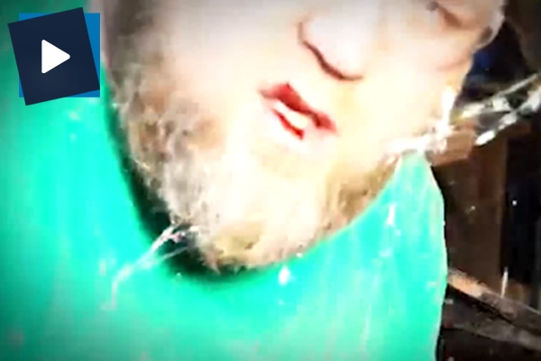 Atölyede fırlayan ahşap önce dişini sonra kamera lensini kırdı