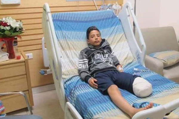 İsrail'in vurduğu çocuğun bacağı kesildi