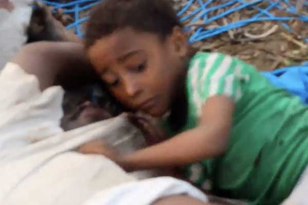 Yemen'de acı sürüyor... 'Babam uyuyor, uyanacak!'