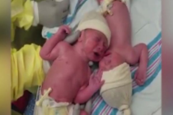 İkiz bebekler fenomen oldu