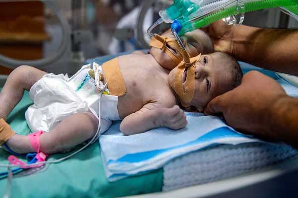 Gazze'de yenidoğan ölümleri artıyor