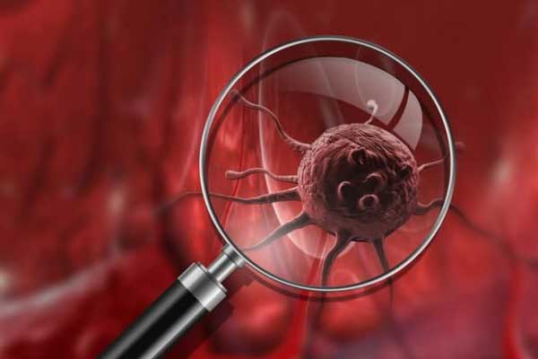 Kansere karşı D vitamini alın