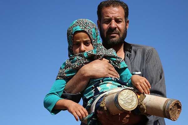 Suriyeli Maya protez tedavisi için İstanbul'da