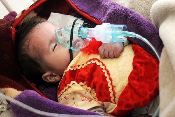 Yemen'de kolera can almaya devam ediyor