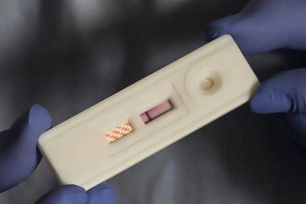 HIV salgınının yeniden alevleneceği uyarısı