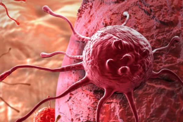 Kanserli hücrelerin çoğalmasını önleyen madde bulundu