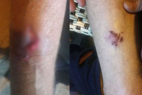 Evinden çıkarken 6 köpeğin saldırısına uğradı