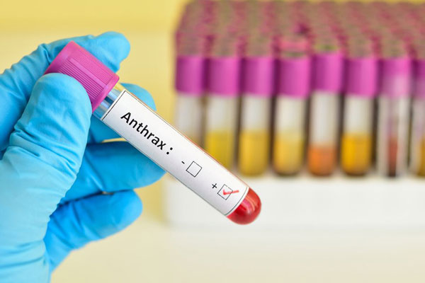 Şarbon hastalığı nedir? Şarbon belirtileri nelerdir ve nasıl bulaşır?