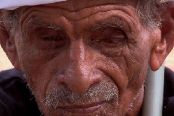 Akraba evliliği bir köyü kör etti