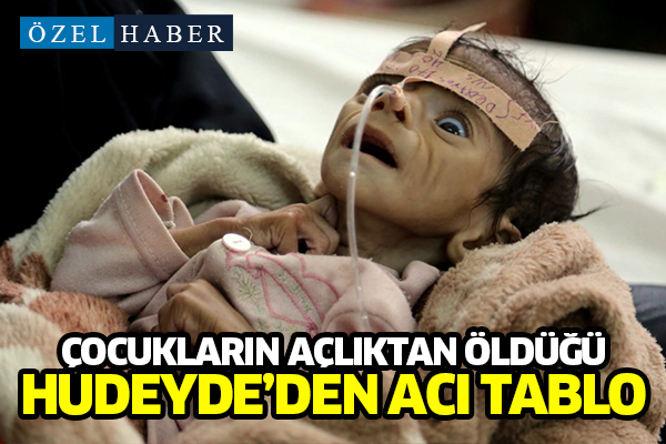 Açlıktan ölümlerin yaşandığı Yemen'in Hudeyde kentinden acı tablo