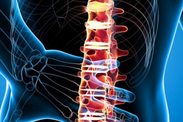 Yıllardır yanlış biliyormuşuz! İşte bel fıtığının çözümü...