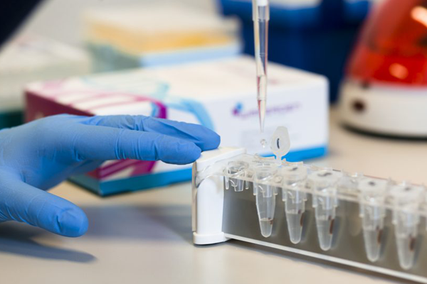 Tükürük örneğiyle PKK’lı terörist yakalandı!