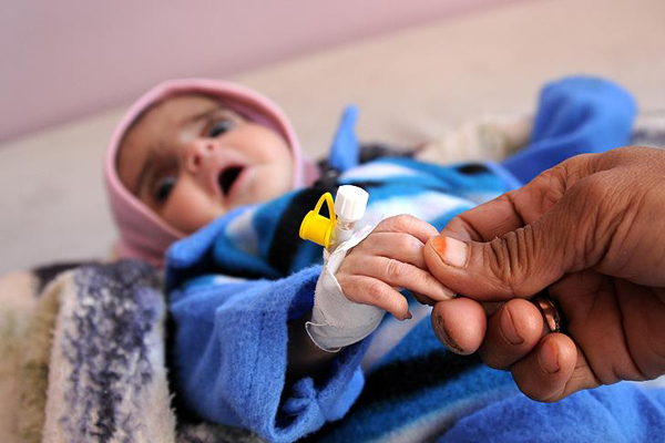 'Yemen'de 10 dakikada 1 çocuk ölüyor'