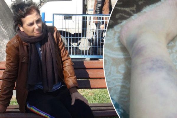 Şiddet mağduru kadın, yetkililerden yardım bekliyor