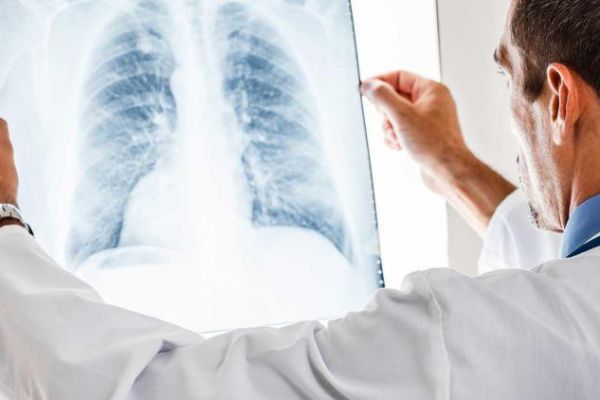 Bakteri kaynaklı zatürre kalp için daha tehlikeli