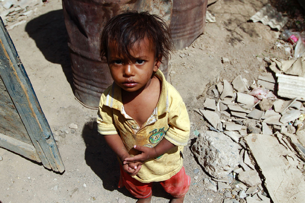 Yemen'de 85 bin çocuk açlık veya hastalık yüzünden öldü