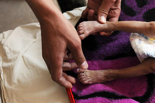 'Milyonlarca Yemenli aç uyuyor'