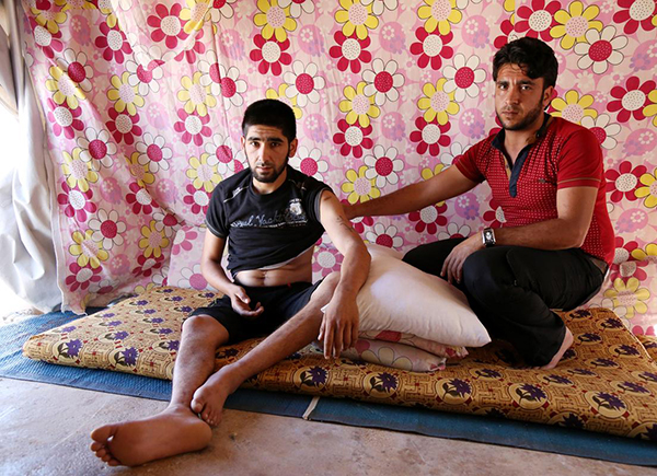 Savaşın 'Engelli Yaşamaya' Mahkum Ettiği Suriyeliler - 9