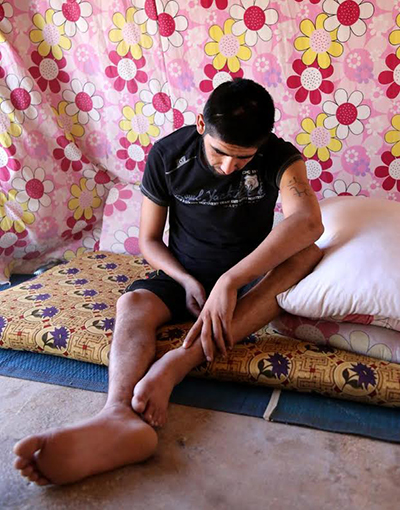 Savaşın 'Engelli Yaşamaya' Mahkum Ettiği Suriyeliler - 11