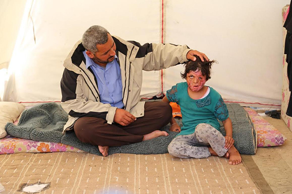 Suriyeli Emira'nın yüzündeki savaşın izleri silinecek - 5