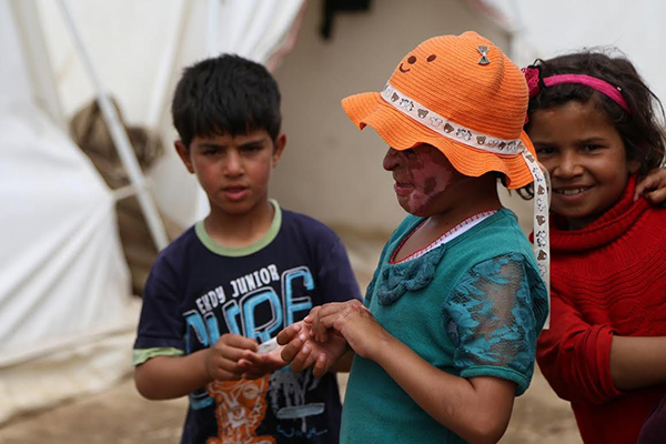 Suriyeli Emira'nın yüzündeki savaşın izleri silinecek - 7