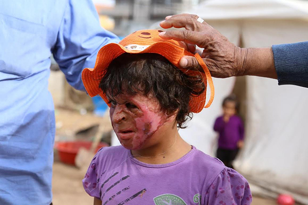 Suriyeli Emira'nın yüzündeki savaşın izleri silinecek - 4