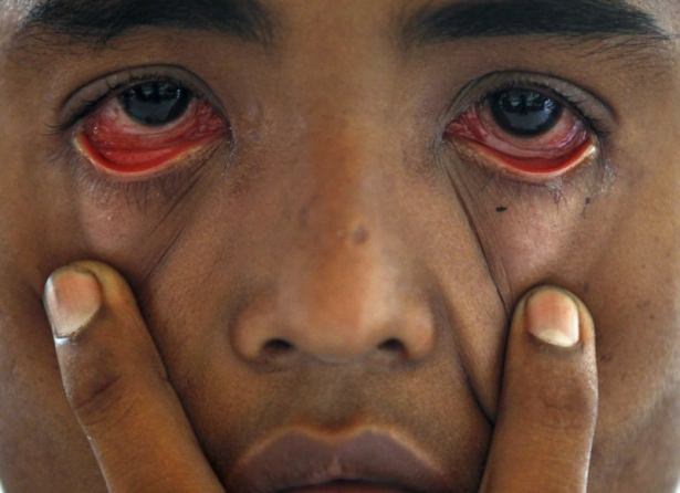 Arakanlı Müslümanlar yağmur suyu içiyor - 12