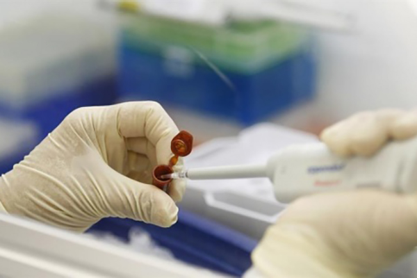 2015 te en çok neyi arattık? - 3