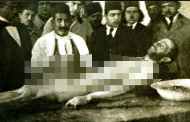 Ömer Seyfettin'in korkunç ölümü - 5