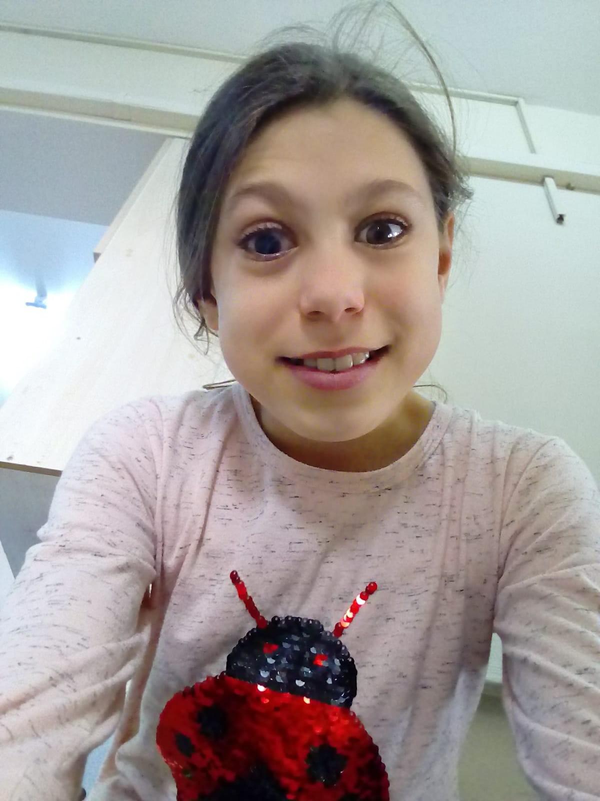 Poşeti bıçakla açmak istedi, az kalsın gözünden oluyordu - 7