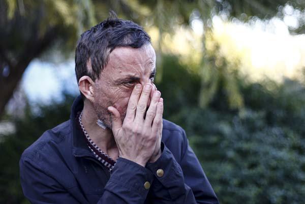 Türkiye'de ilk yüz nakli yapılan Uğur Acar yeni yüzüyle mutlu - 6