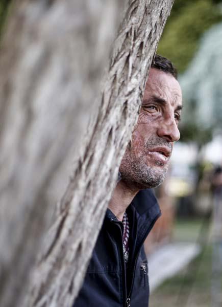 Türkiye'de ilk yüz nakli yapılan Uğur Acar yeni yüzüyle mutlu - 5